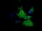 ZFP36 Ring Finger Protein antibody, GTX83405, GeneTex, Immunocytochemistry image 