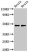 Corticotropin Releasing Hormone Receptor 2 antibody, LS-C669946, Lifespan Biosciences, Western Blot image 