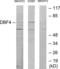 Protein DBF4 homolog A antibody, LS-C119300, Lifespan Biosciences, Western Blot image 