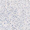 ITGB4 antibody, AMAb91454, Atlas Antibodies, Immunohistochemistry frozen image 