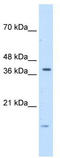 Transcription Factor B2, Mitochondrial antibody, TA345362, Origene, Western Blot image 