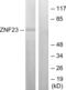 Zinc Finger Protein 23 antibody, abx013403, Abbexa, Western Blot image 