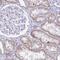 Bardet-Biedl Syndrome 1 antibody, PA5-63546, Invitrogen Antibodies, Immunohistochemistry frozen image 