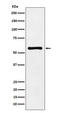 P21 (RAC1) Activated Kinase 2 antibody, M01419, Boster Biological Technology, Western Blot image 