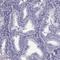 MAGE Family Member B2 antibody, HPA075519, Atlas Antibodies, Immunohistochemistry frozen image 