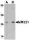 NSE2 (MMS21) Homolog, SMC5-SMC6 Complex SUMO Ligase antibody, orb75425, Biorbyt, Western Blot image 