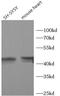 N-Acylsphingosine Amidohydrolase 1 antibody, FNab00618, FineTest, Western Blot image 