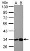 3-Hydroxyisobutyrate Dehydrogenase antibody, LS-C155742, Lifespan Biosciences, Western Blot image 