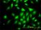 Rap Guanine Nucleotide Exchange Factor 6 antibody, H00051735-M01, Novus Biologicals, Immunofluorescence image 