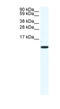 C-C Motif Chemokine Ligand 5 antibody, MBS832494, MyBioSource, Western Blot image 