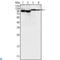 Bruton Tyrosine Kinase antibody, LS-C812406, Lifespan Biosciences, Western Blot image 