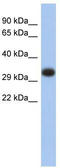 Major Histocompatibility Complex, Class II, DP Alpha 1 antibody, TA342062, Origene, Western Blot image 