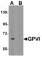 GP6 antibody, PA5-20582, Invitrogen Antibodies, Western Blot image 