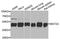 Methionine Adenosyltransferase 2A antibody, A8436, ABclonal Technology, Western Blot image 