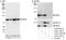 Interleukin Enhancer Binding Factor 3 antibody, A303-651A, Bethyl Labs, Immunoprecipitation image 