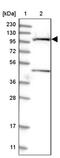 Solute Carrier Family 9 Member A2 antibody, PA5-57163, Invitrogen Antibodies, Western Blot image 