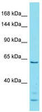 EPH Receptor A3 antibody, TA344263, Origene, Western Blot image 