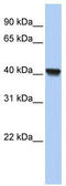 Clavesin 1 antibody, TA337779, Origene, Western Blot image 