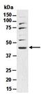 Sonic Hedgehog Signaling Molecule antibody, orb66794, Biorbyt, Western Blot image 