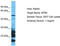 Netrin 5 antibody, TA337473, Origene, Western Blot image 