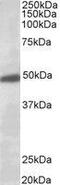 Potassium Voltage-Gated Channel Subfamily J Member 6 antibody, GTX88962, GeneTex, Western Blot image 
