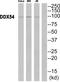 DEAD-Box Helicase 54 antibody, PA5-39043, Invitrogen Antibodies, Western Blot image 