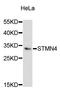 Stathmin 4 antibody, STJ27024, St John