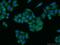 Left-Right Determination Factor 2 antibody, 13991-1-AP, Proteintech Group, Immunofluorescence image 