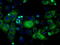 Hydroxysteroid 17-Beta Dehydrogenase 10 antibody, LS-C114888, Lifespan Biosciences, Immunofluorescence image 