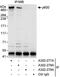 Ubiquitin Protein Ligase E3 Component N-Recognin 4 antibody, A302-277A, Bethyl Labs, Immunoprecipitation image 