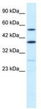 A-Kinase Anchoring Protein 17A antibody, TA335725, Origene, Western Blot image 