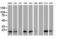 Destrin antibody, LS-C337314, Lifespan Biosciences, Western Blot image 