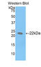 LIF Interleukin 6 Family Cytokine antibody, LS-C295133, Lifespan Biosciences, Western Blot image 