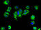 Brain mitochondrial carrier protein 1 antibody, A63430-100, Epigentek, Immunofluorescence image 