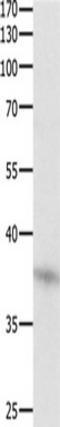 Dual specificity protein phosphatase 12 antibody, TA322432, Origene, Western Blot image 