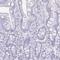 Serpin Family I Member 1 antibody, NBP2-38784, Novus Biologicals, Immunohistochemistry paraffin image 