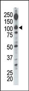 Diacylglycerol Kinase Iota antibody, AP15086PU-N, Origene, Western Blot image 