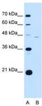 Sialic Acid Binding Ig Like Lectin 9 antibody, TA341937, Origene, Western Blot image 