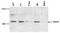 PHD Finger Protein 8 antibody, GTX17508, GeneTex, Western Blot image 