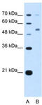 Cerebellar Degeneration Related Protein 2 antibody, TA339869, Origene, Western Blot image 