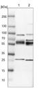 PHD Finger Protein 24 antibody, NBP1-90937, Novus Biologicals, Western Blot image 