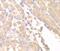 SUFU Negative Regulator Of Hedgehog Signaling antibody, FNab08373, FineTest, Immunohistochemistry paraffin image 