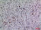 Fibroblast Growth Factor 5 antibody, A03776-1, Boster Biological Technology, Immunohistochemistry paraffin image 