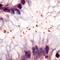 Helicobacter pylori antibody, NB120-7788, Novus Biologicals, Immunohistochemistry frozen image 