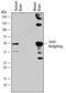 Sonic hedgehog protein antibody, MAB464, R&D Systems, Western Blot image 