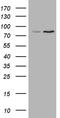 ATP Binding Cassette Subfamily D Member 2 antibody, LS-C792334, Lifespan Biosciences, Western Blot image 