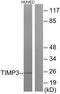 TIMP Metallopeptidase Inhibitor 3 antibody, TA314625, Origene, Western Blot image 