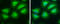 ATP Citrate Lyase antibody, GTX112379, GeneTex, Immunofluorescence image 