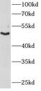 Keratin 14 antibody, FNab02197, FineTest, Western Blot image 