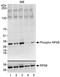 Ribosomal Protein S6 antibody, A300-584A, Bethyl Labs, Western Blot image 